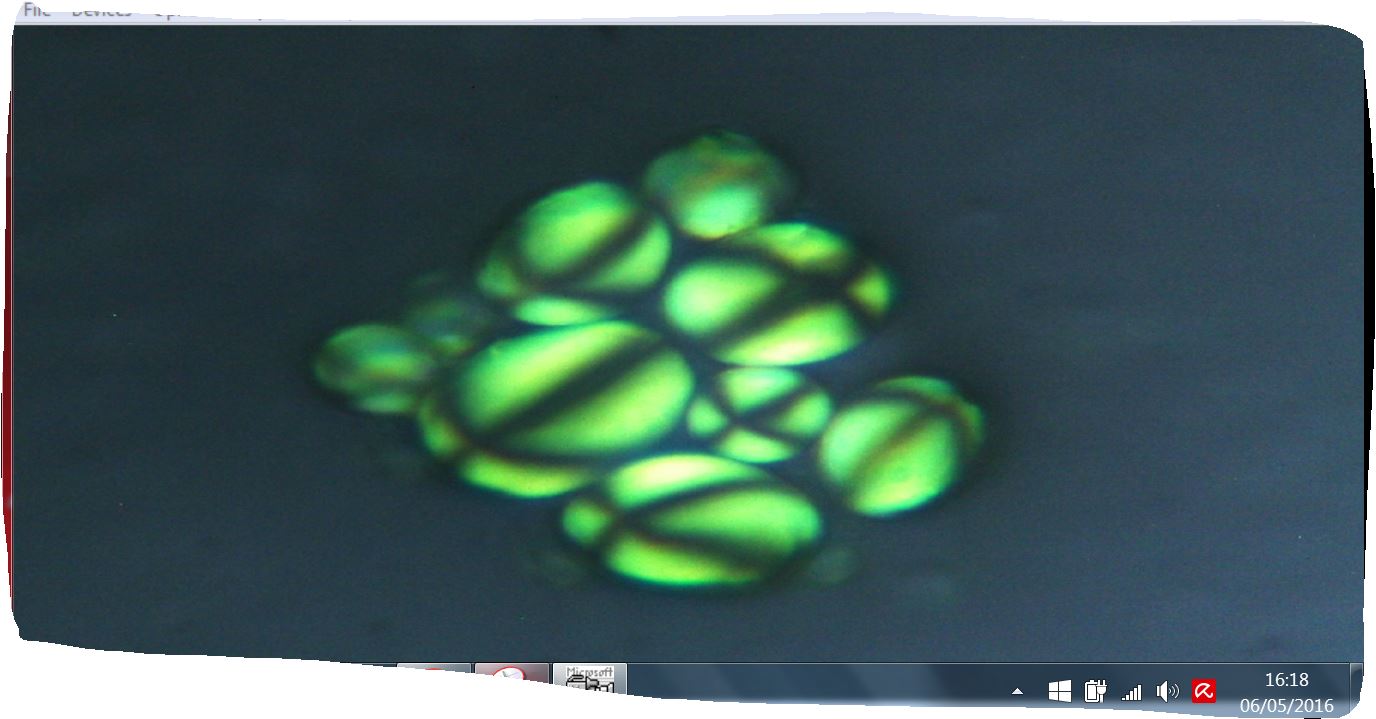 vorticella?